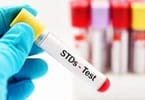 افزایش «آزاردهنده» عفونت های مقاربتی در اروپا