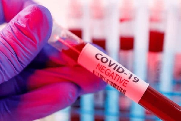 نتایج منفی آزمون COVID-19 برای سفر به مونتسرات لازم است