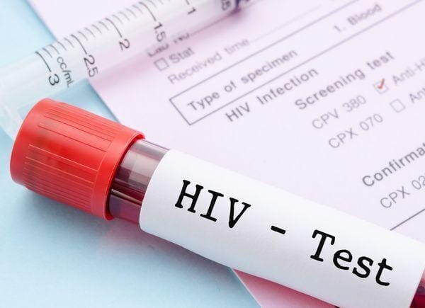 Strain HIV baru yang sangat mudah berjangkit dan berbahaya ditemui di Eropah