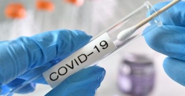 Квалификациялуу конокторго акысыз COVID-19 тестирлөөсүн сунуш кылган Сент-Люсия мейманканалары