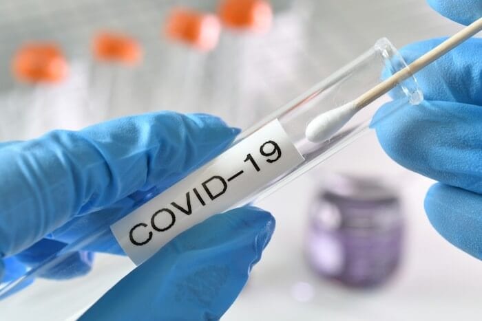 מלונות בסנט לוסיה המציעים בדיקות COVID-19 בחינם לאורחים מוסמכים
